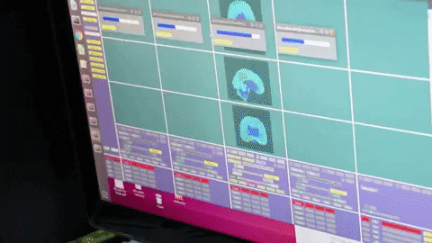 AI- Driven COVID-19 Detection System